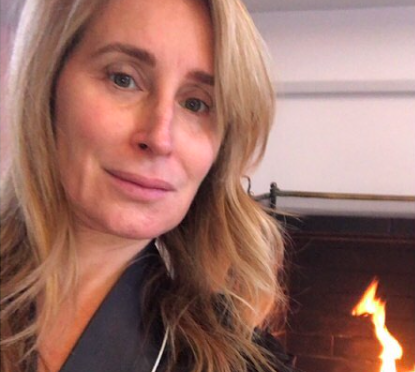 Sonja Morgan’s Beauty Secrets – Skincare, Botox, Facials, and More