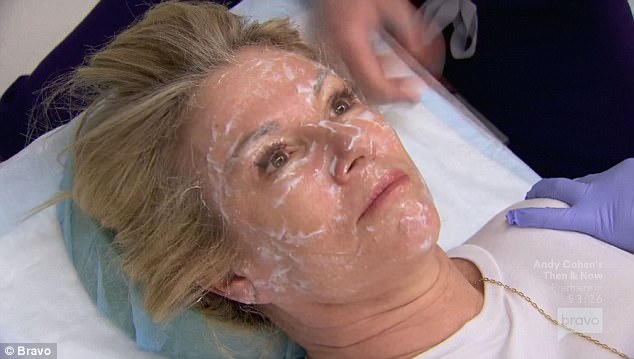 Ramona Singer getting a facial procedure starting with numbing cream