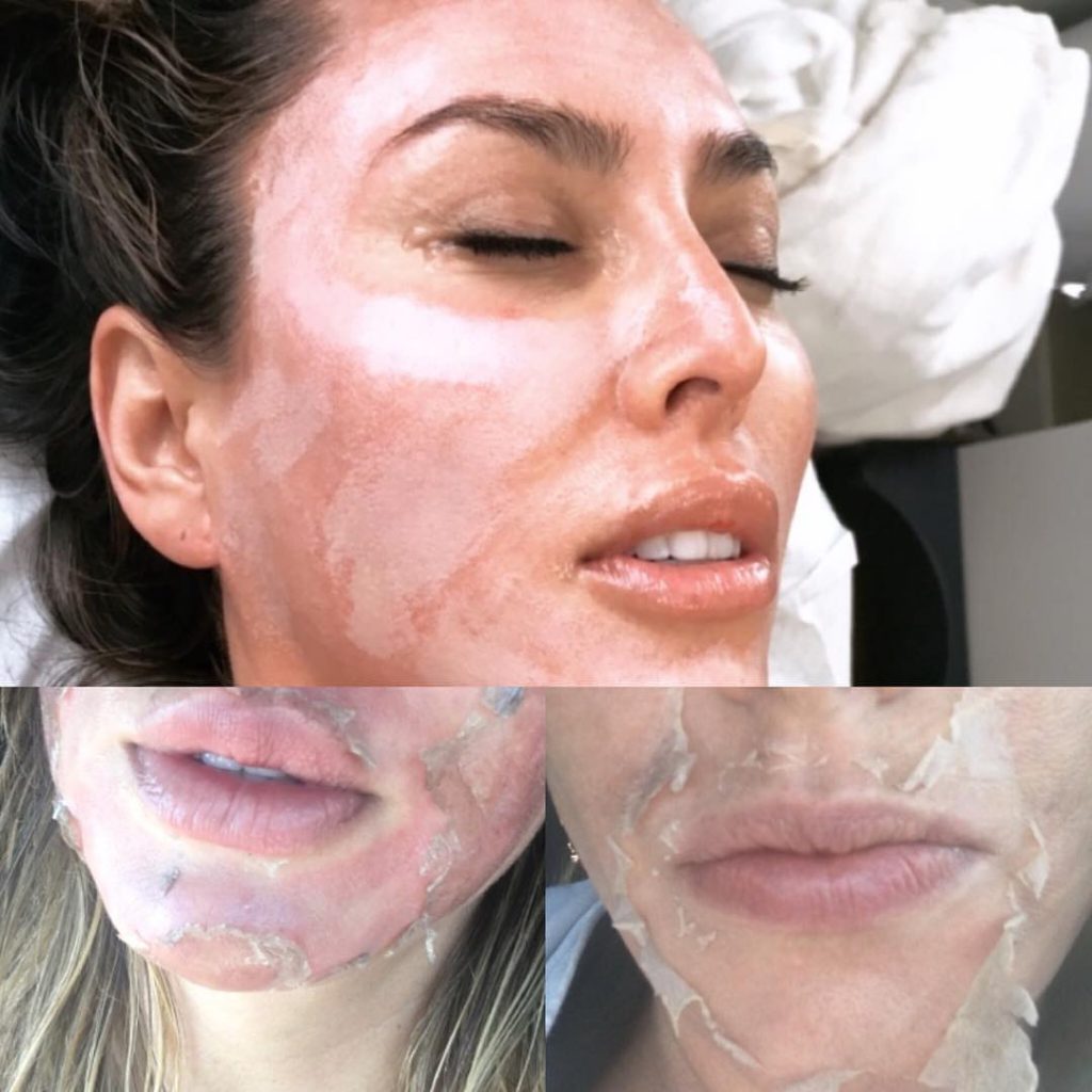 Kelly Dodd getting a custom peel at CosmetiCare